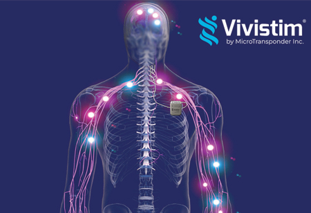 MicroTransponder: Rethinking Stroke Recovery with Vagus Nerve Stimulation MicroTransponder: Rethinking Stroke Recovery with Vagus Nerve Stimulation