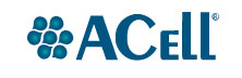ACell: Regenerative Medicine to Support Wound Healing