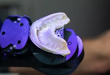 Advancing Clinical Consistency in Digital Dental Sleep Orthotics