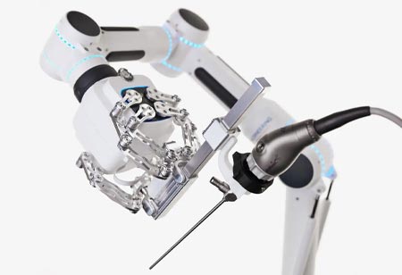 Advancing Precision in Flexible Endoscopic Surgery