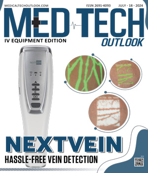 Top IV Equipment Providers NextVein: Hassle-Free Vein Detection